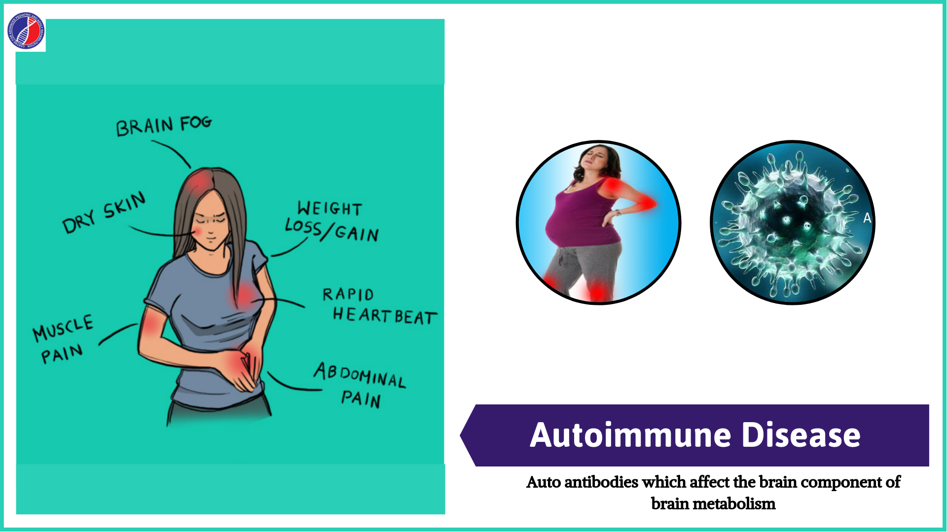 Autoimmune Disease | Best Centre for Autism in Bangalore